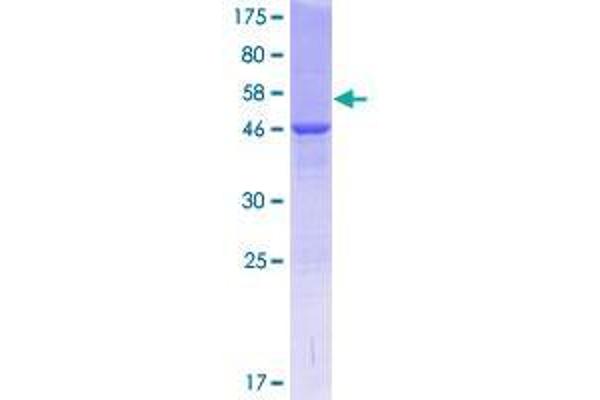 COMMD4 Protein (AA 1-199) (GST tag)