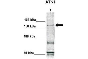 WB Suggested Anti-ATN1 Antibody  Positive Control: Lane1: 30ug human fibroblasts  Primary Antibody Dilution :  1:500 Secondary Antibody :  Anti-rabbit-HRP  Secondry Antibody Dilution :  1:1000 Submitted by: Anonymous (Atrophin 1 antibody  (N-Term))