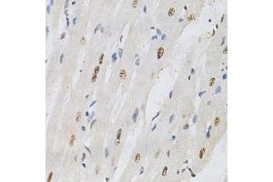 Immunohistochemistry of paraffin-embedded rat heart using KPNA4 Antibody (ABIN5971058) at dilution of 1/200 (40x lens). (KPNA4 antibody)