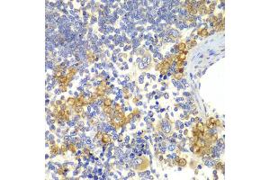 Immunohistochemistry of paraffin-embedded rat spleen using NOTCH1 antibody (ABIN5995370) at dilution of 1/100 (40x lens). (Notch1 antibody)