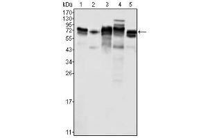 Western Blotting (WB) image for anti-Metadherin (MTDH) antibody (ABIN1108306) (MTDH antibody)