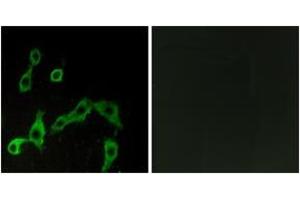 Immunofluorescence analysis of LOVO cells, using ADRA2A Antibody. (ADRA2A antibody  (AA 281-330))