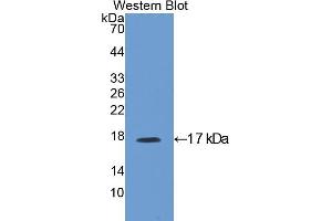 Western blot analysis of the recombinant protein. (IGFBP3 antibody  (AA 137-274))