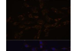 Immunofluorescence analysis of C6 cells using RGS4 Polyclonal Antibody at dilution of 1:100. (RGS4 antibody)