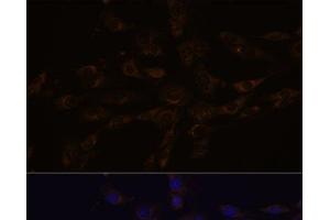 Immunofluorescence analysis of C6 cells using RGS4 Polyclonal Antibody at dilution of 1:100.