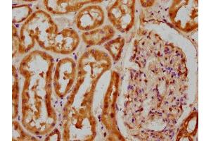 IHC image of ABIN7148257 diluted at 1:100 and staining in paraffin-embedded human kidney tissue performed on a Leica BondTM system. (COL4a5 antibody  (AA 1184-1235))