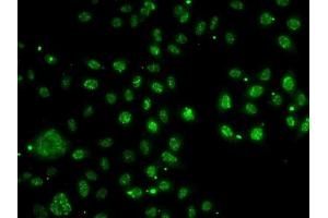 Immunofluorescence analysis of A-549 cells using LDLR antibody (ABIN6127366, ABIN6143131, ABIN6143132 and ABIN6222897). (LDLRAP1 antibody  (AA 59-308))