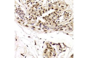 Immunohistochemistry of paraffin-embedded Human mammary gland using SNRPA antibody at dilution of 1:100 (x400 lens). (SNRPA1 antibody)