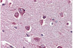 Anti-DPP10 antibody  ABIN1048507 IHC staining of human brain, cortex. (DPP10 antibody  (Internal Region))