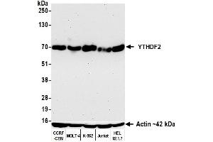 Western Blotting (WB) image for anti-YTH Domain Family, Member 2 (YTHDF2) (AA 300-350) antibody (ABIN7795701) (Recombinant YTHDF2 antibody  (AA 300-350))