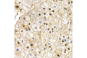 Immunohistochemistry of paraffin-embedded human liver injury using RAD9A antibody (ABIN5970971) at dilution of 1/200 (40x lens). (RAD9A antibody)