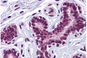 Human Breast: Formalin-Fixed, Paraffin-Embedded (FFPE) (KPNA4 antibody  (N-Term))