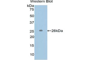 Western blot analysis of the recombinant protein. (L1CAM antibody  (AA 218-423))