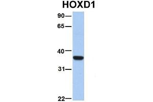 Host:  Rabbit  Target Name:  ETV5  Sample Type:  Human Fetal Liver  Antibody Dilution:  1. (ETV5 antibody  (N-Term))