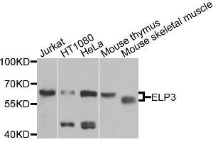 Western blot analysis of extracts of various cells, using ELP3 antibody. (ELP3/KAT9 antibody)