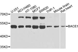 Western blot analysis of extracts of various cells, using BACE1 antibody. (BACE1 antibody)