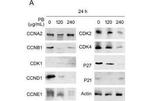 PB downregulates several proteins related to cell cycle progression, morphology, cell-cell adhesion and cell migration. (CDK2 antibody)