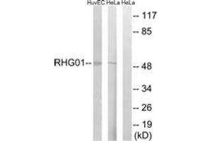 Western blot analysis of extracts from HeLa/HuvEc cells, using RHG1 Antibody. (RHG1 (AA 189-238) antibody)