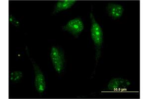 Immunofluorescence of monoclonal antibody to SOLH on HeLa cell. (Calpain 15/SOLH antibody  (AA 993-1086))