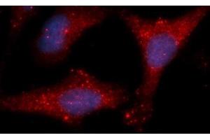 Immunofluorescence (IF) image for anti-Lactate Dehydrogenase B (LDHB) (AA 1-334) antibody (APC) (ABIN5565783) (LDHB antibody  (AA 1-334) (APC))
