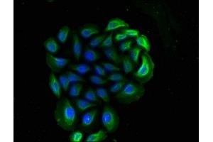 Immunofluorescence staining of A549 cells with ABIN7160185 at 1:90, counter-stained with DAPI. (CD14 antibody  (AA 20-345))