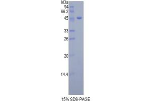 SDS-PAGE analysis of Mouse Dermatopontin Protein.