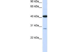 WB Suggested Anti-GCDH Antibody Titration:  0. (GCDH antibody  (N-Term))