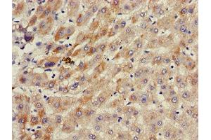 Immunohistochemistry of paraffin-embedded human liver tissue using ABIN7143187 at dilution of 1:100 (ACAD11 antibody  (AA 225-388))