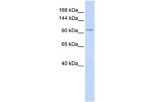 Western Blotting (WB) image for anti-Transient Receptor Potential Cation Channel, Subfamily C, Member 6 (TRPC6) (Middle Region) antibody (ABIN2776163)