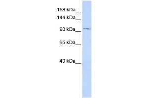 WB Suggested Anti-TRPC6 Antibody Titration:  0. (TRPC6 antibody  (Middle Region))