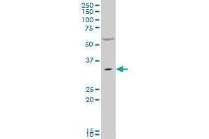 PEX7 polyclonal antibody (A01), Lot # 051122JC01. (PEX7 antibody  (AA 2-99))