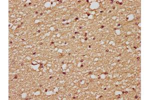 IHC image of ABIN7175125 diluted at 1:200 and staining in paraffin-embedded human brain tissue performed on a Leica BondTM system. (PLAUR antibody  (AA 23-305))