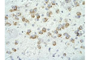 Immunohistochemistry (IHC) image for anti-Mediator Complex Subunit 17 (MED17) (N-Term) antibody (ABIN2778320)