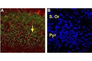 Expression of EAAT2 in rat hippocampusImmunohistochemical staining of perfusion-fixed, free floating frozen rat brain sections with Anti-EAAT2  (extracellular) Antibody (ABIN7043660, ABIN7044354 and ABIN7044355).