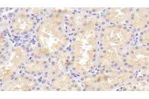 Detection of TANK in Human Kidney Tissue using Polyclonal Antibody to TRAF Family Member Associated NFKB Activator (TANK) (TANK antibody  (AA 131-369))
