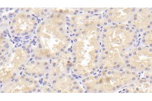 Detection of TANK in Human Kidney Tissue using Polyclonal Antibody to TRAF Family Member Associated NFKB Activator (TANK) (TANK antibody  (AA 131-369))