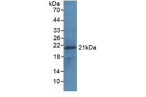SDS-PAGE (SDS) image for Interleukin 1, beta (IL1B) ELISA Kit (ABIN6574165)