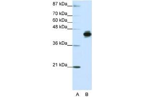 WB Suggested Anti-KRT18 Antibody Titration:  1. (Cytokeratin 18 antibody  (N-Term))