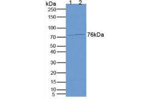 Figure. (CEA antibody  (AA 93-221))