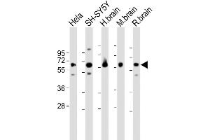 All lanes : Anti-GDI1 Antibody (C-term) at 1:1000-1:2000 dilution Lane 1: Hela whole cell lysate Lane 2: SH-SY5Y whole cell lysate Lane 3: H. (GDI1 antibody  (C-Term))