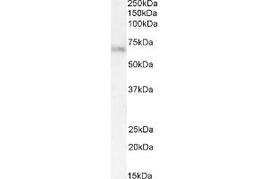 Western Blotting (WB) image for anti-Alpha2 Antiplasmin (SERPINF2) (Internal Region) antibody (ABIN334343)