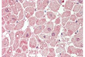 Rabbit Anti-PLA2G5 antibody  Formalin Fixed Paraffin Embedded Tissue: Human Heart Primary antibody Concentration: 1:100 Secondary Antibody: Donkey anti-Rabbit-Cy3 Secondary Antibody Concentration: 1:200 Magnification: 20x Exposure Time: 0. (PLA2G5 antibody  (N-Term))