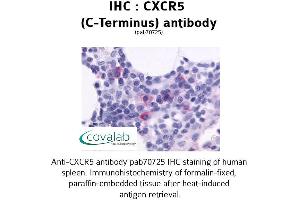 Image no. 1 for anti-Chemokine (C-X-C Motif) Receptor 5 (CXCR5) (C-Term) antibody (ABIN1733411) (CXCR5 antibody  (C-Term))