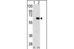 Western blot analysis of FR (arrow) using FR Antibody (C-term) (ABIN388938 and ABIN2850529).