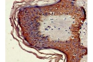 Immunohistochemistry of paraffin-embedded human skin tissue using ABIN7160462 at dilution of 1:100 (MNDA antibody  (AA 84-233))
