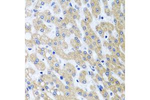 Immunohistochemistry of paraffin-embedded human liver injury using PRMT2 antibody at dilution of 1:100 (x40 lens). (PRMT2 antibody)