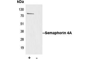 Immunoprecipitation of Semaphorin 4A from 0. (Sema4a antibody  (Center))