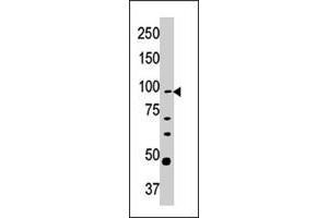 Western blot analysis of CPT1A polyclonal antibody  in Y-79 cell line lysate (35 ug/lane). (CPT1A antibody  (C-Term))