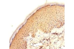 Immunohistochemistry of paraffin-embedded human skin tissue using ABIN7165631 at dilution of 1:100 (C11orf73 antibody  (AA 1-197))