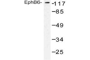 Western blot (WB) analysis of EphB6 antibody in extracts from COLO cells. (EPH Receptor B6 antibody)